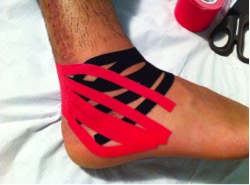 methode kinesio taping sur une cheville