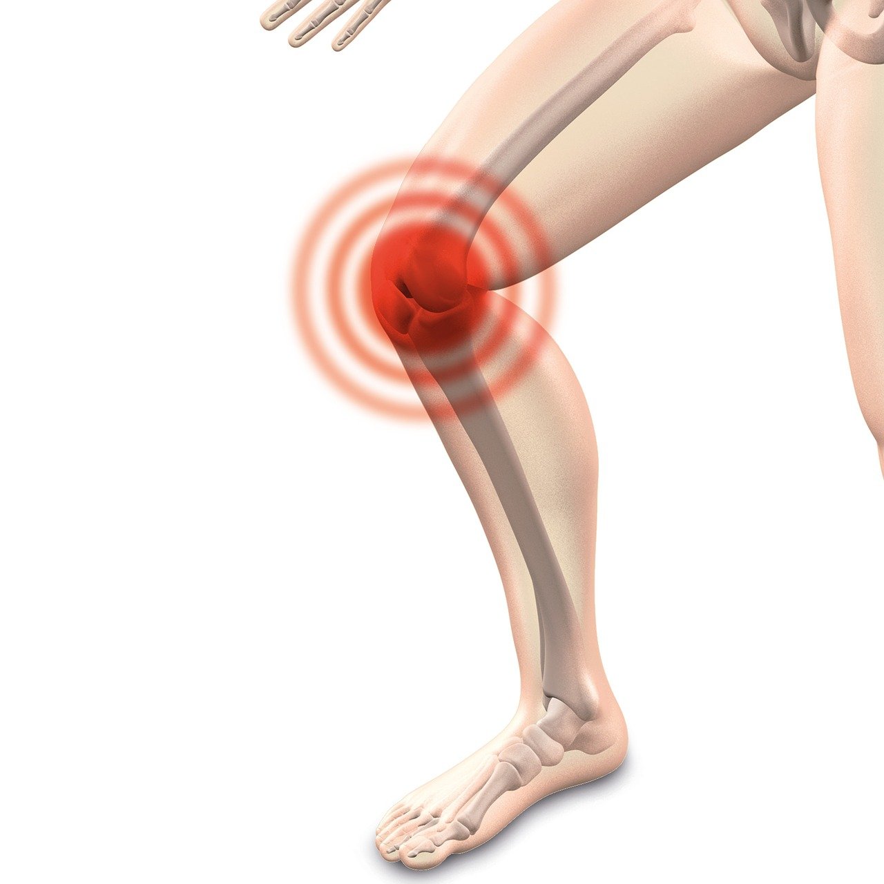 image pour illustrer la douleur au genou